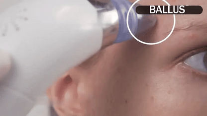 Pore Cleaning Device | جهاز تنظيف المسام العميق